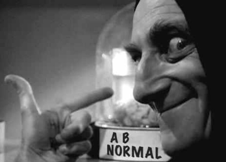 bd0afa127ca0688ba77242c49067f417--marty-feldman-young-frankenstein.jpg